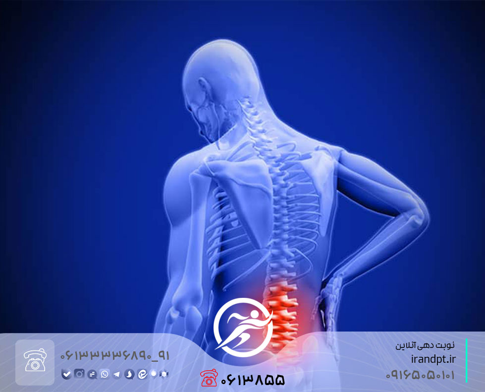 درمان گودی کمر و کمر صاف با فیزیوتراپی