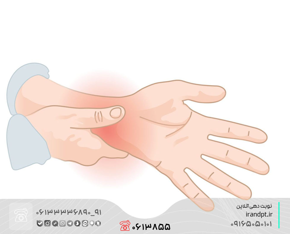 درمان گرفتگی کانال عصب مچ دست با فیزیوتراپی
