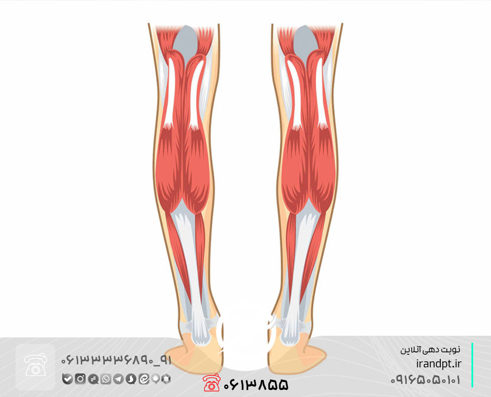 درمان آسیب و پارگی عضله گاستروکنمیوس (کاف) در تنیس‌بازان با فیزیوتراپی