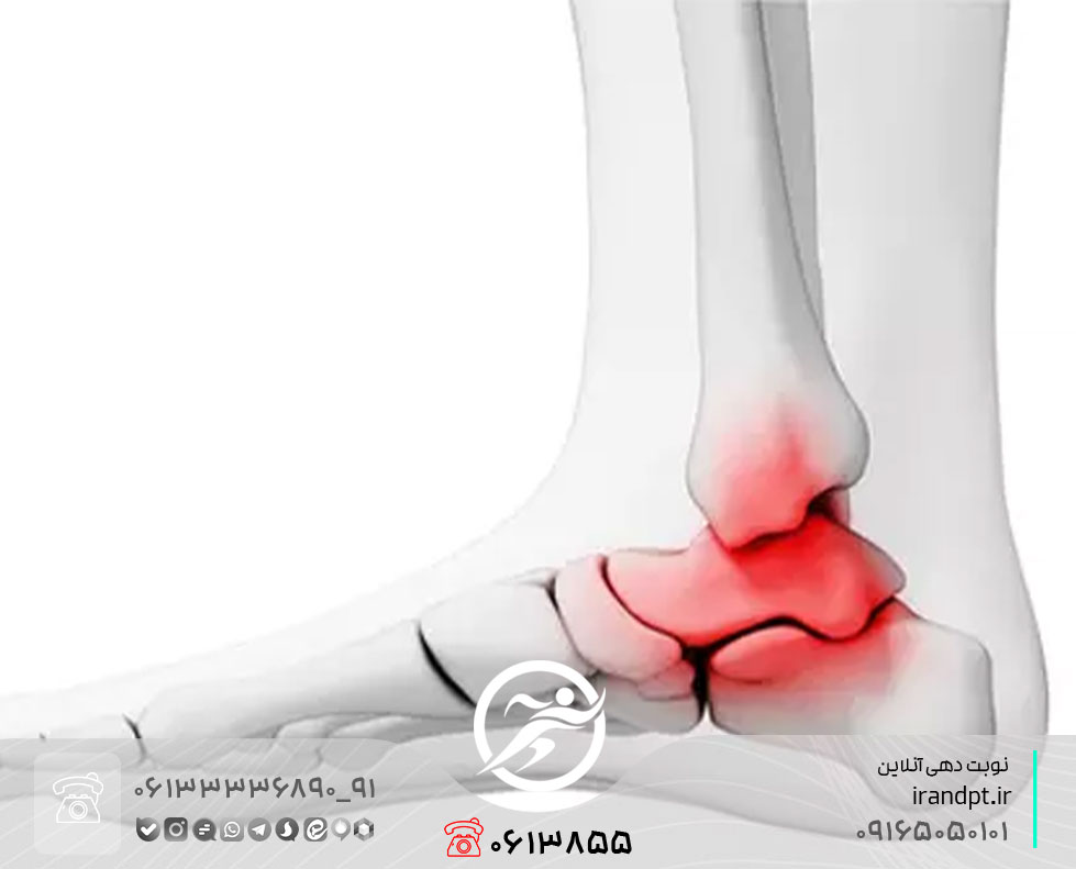 درمان آرتریت روماتوئید مچ پا با فیزیوتراپی